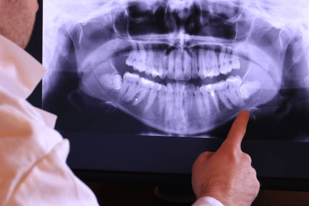 Best 24-Hour Emergency Dental Care in Mckinleyville, CA