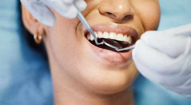 Best Emergency Root Canal Therapy in Mckinleyville, CA